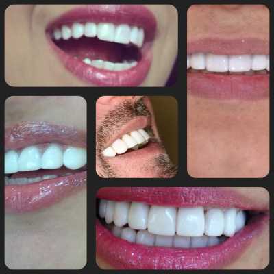 Images