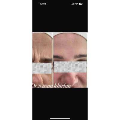Images